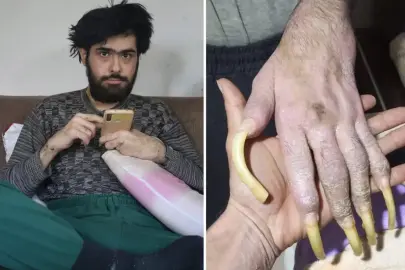 Türkiye'nin konuştuğu Barış'ın yeni işini ve son halini görenler şaşıp kalıyor