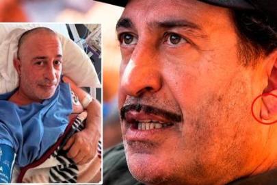 Cem Yılmaz'ın kulağındaki kalp krizi detayı! Doktor çizgiyi gösterdi: 'Yıllardır var'