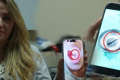 Doktor muayenede fark etti! 10 yaşındaki çocuğun boğazından canlı sülük çıktı