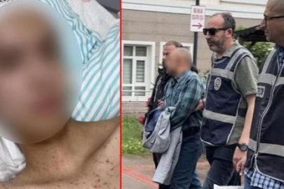 Çocuğu taciz etti, direnince kafasından vurdu! Korkunç olay 1 ay sonra ortaya çıktı: Sağ elinde silah bulunan mağdur solak çıktı