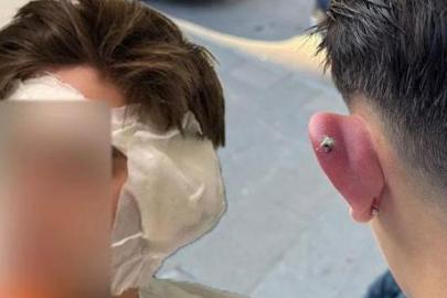 Kulağına piercing taktırdı, hayatı kabusa döndü! 5 gecedir hastanede