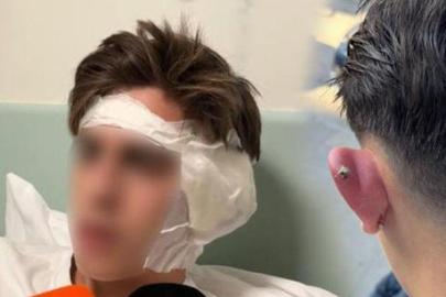 Piercing sonrası hastanelik olmuştu! Korkunç olay sonrası yeni gelişme